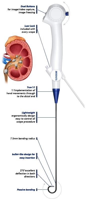 Ureteroscope Full Diagram